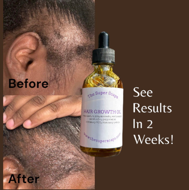 Hair Growth Oil